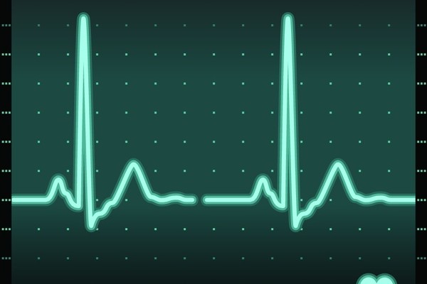 $AAPL – Special Analysis – Working with Oscillators