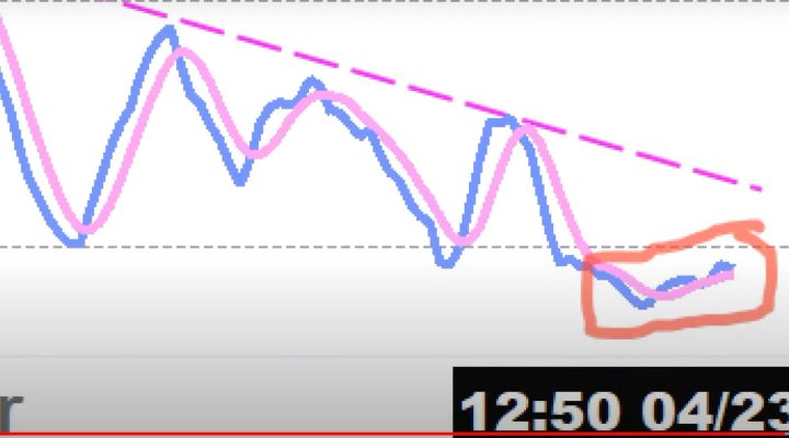 Cure your anxiety by watching this